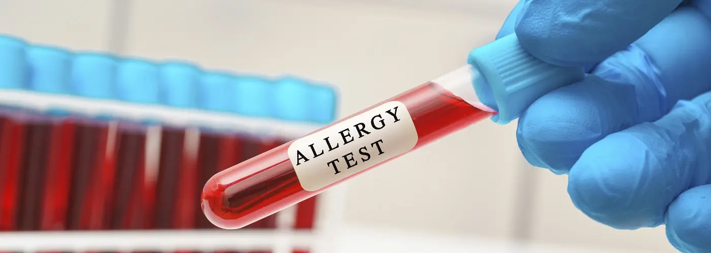 allergy-test-2