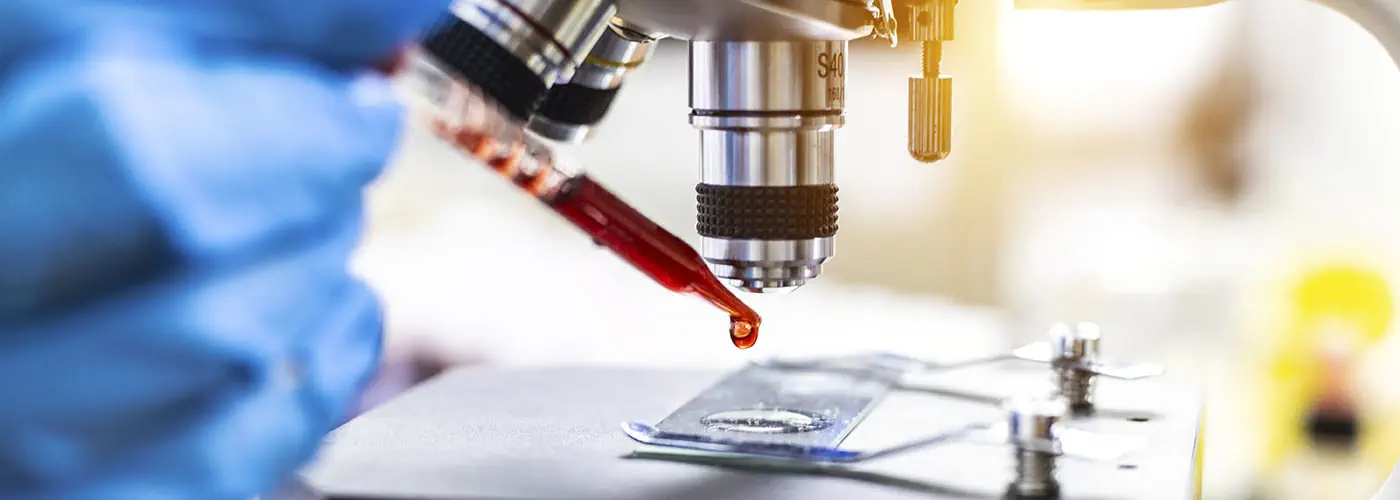 A Haematologist analysing a blood sample in a laboratory