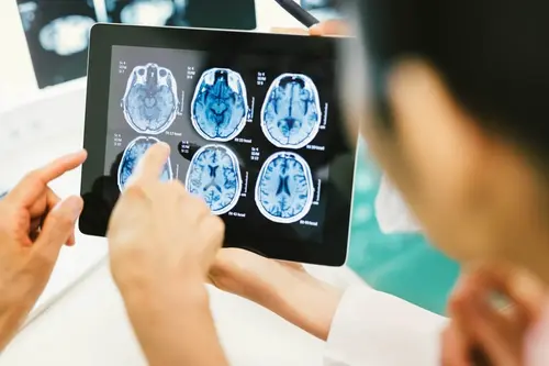 Doctors reviewing brain MRI scans for neurosurgery