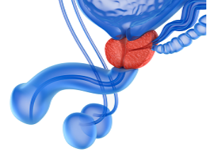 inflamed prostate gland in the male urinary system