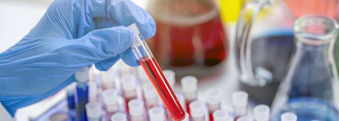 Blood sample being analysed in a lab for haematology testing